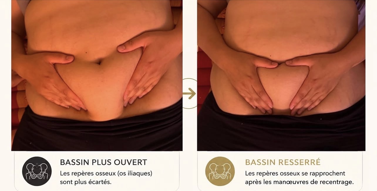 Avant après repositionnement du bassin — formation massage post-partum